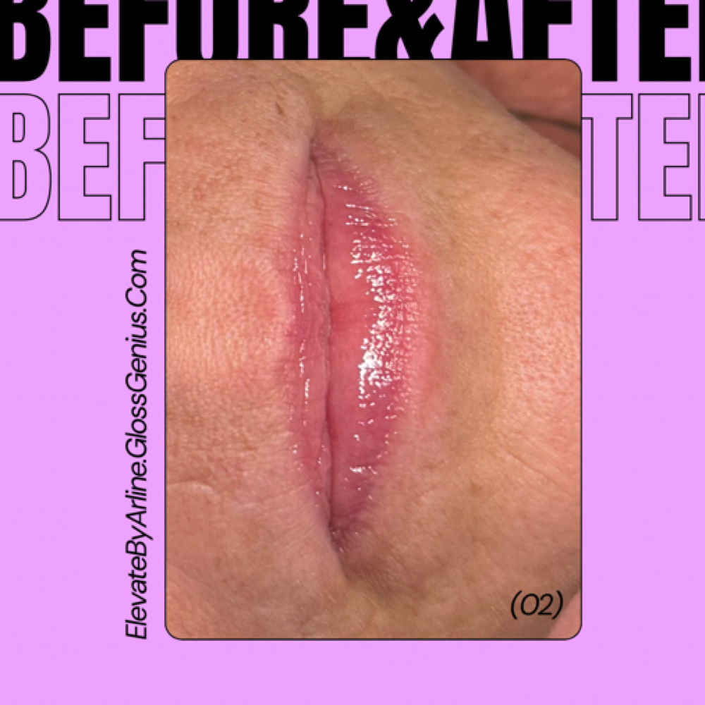 Lip Perk Add-On at Elevate by Arline Transformational Skin & Effortless Beauty in Cedar Park, TX