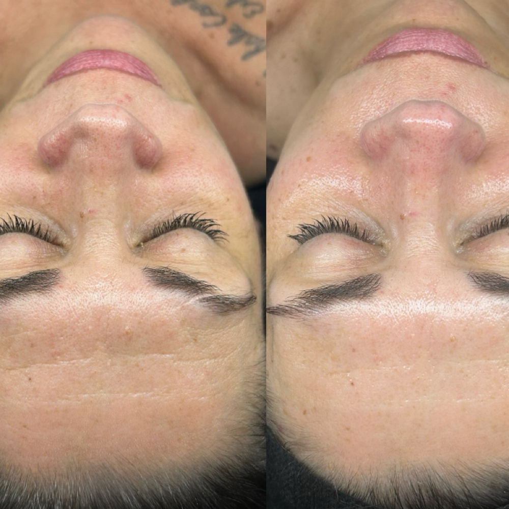 Korean AntiAging Facial at Dream Skin & Beauty in New York, NY