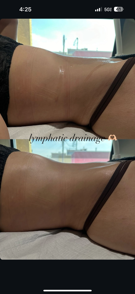 lymphatic massage