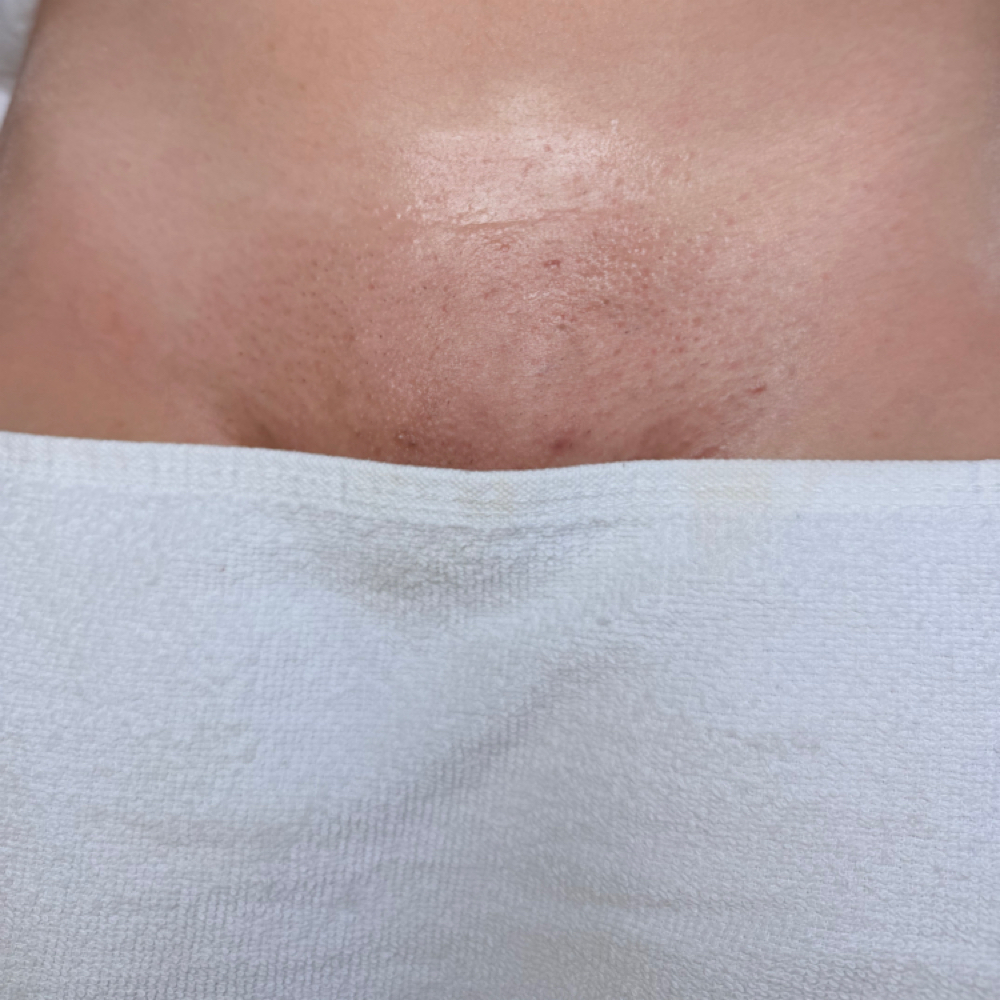 Brazilian Wax at RadiancebyRaina in Elkton, MD