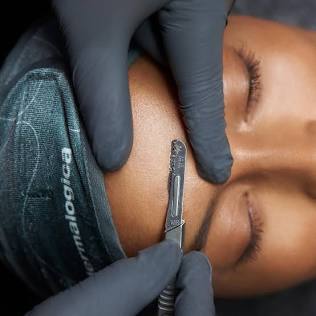 Dermaplaning + Custom Mask at Go And Glow Esthetics in Merrick, NY