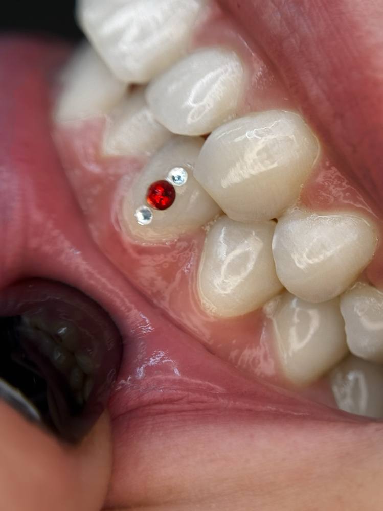 Single Round Crystal Tooth Gems