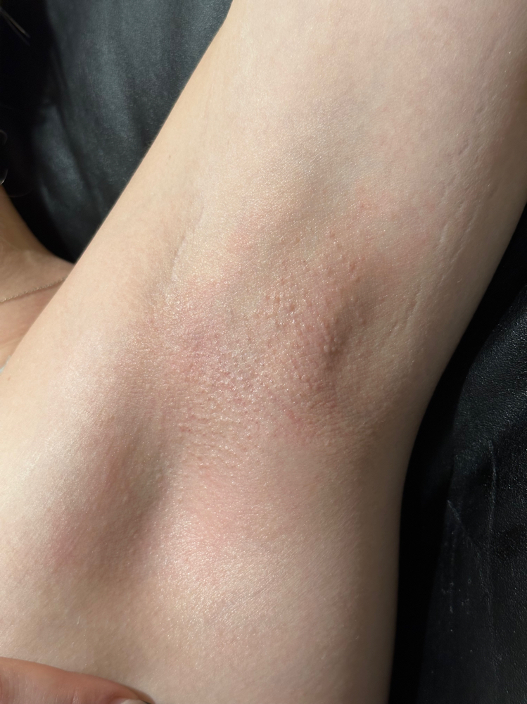 Underarm Wax