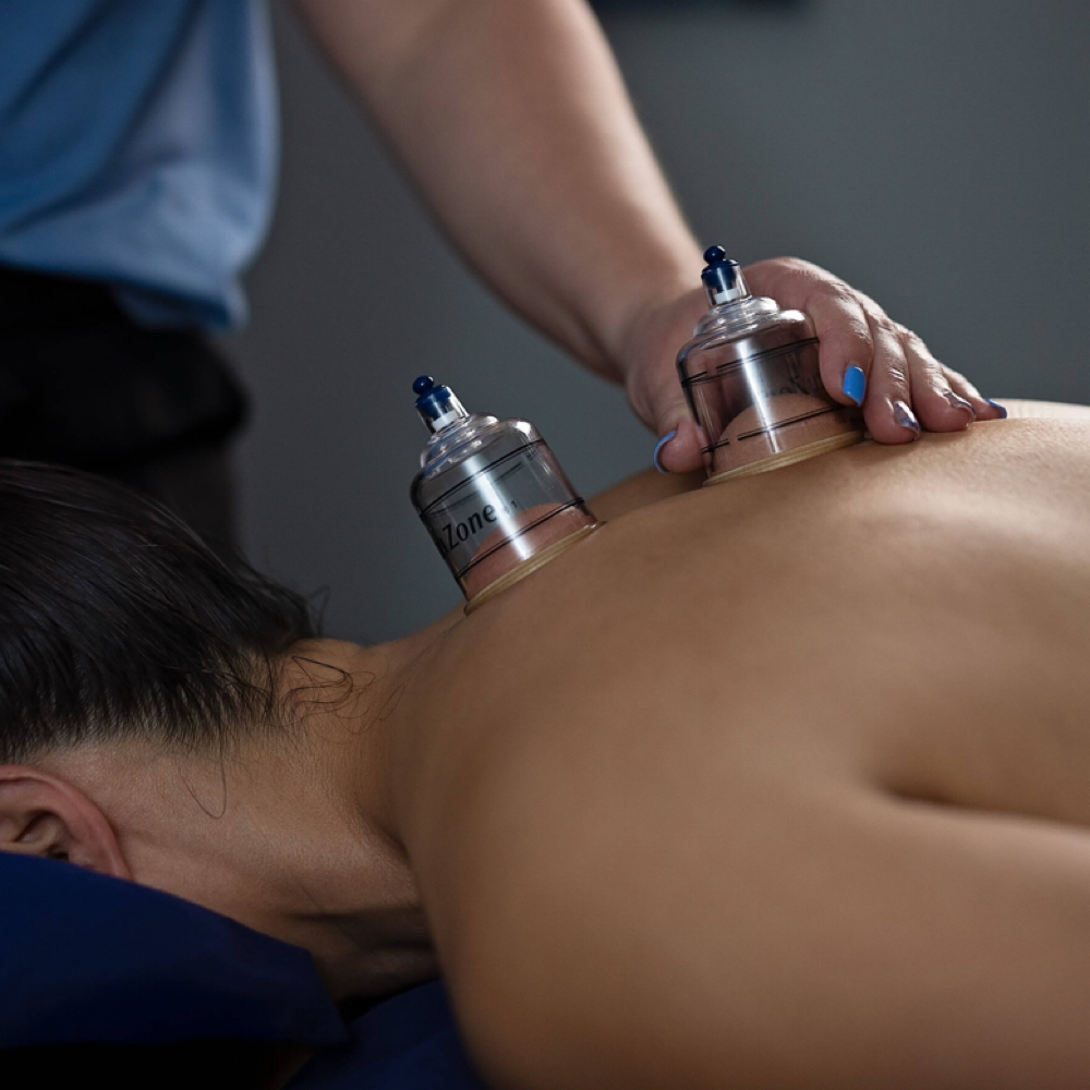 Therapeutic Massage with Cupping at Optimum Massage Therapy in Johnstown, OH