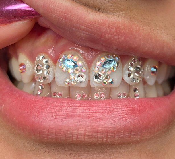 So Icey Set