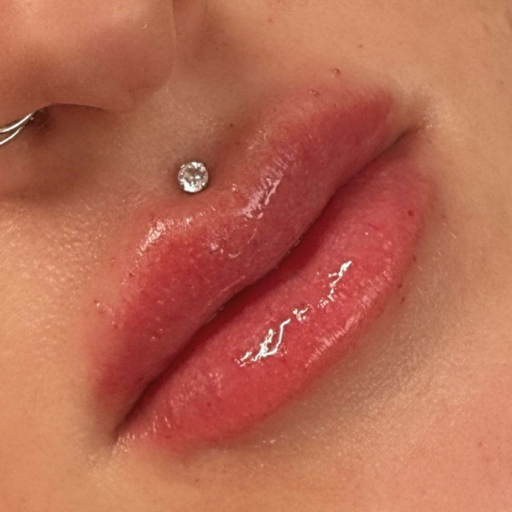 NEW CLIENT 1.5ML LIP at GLOW BY MARTINA in Grass Valley, CA