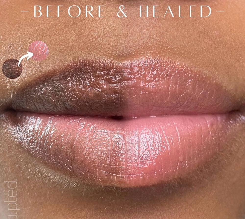 LIP NEUTRALIZATION