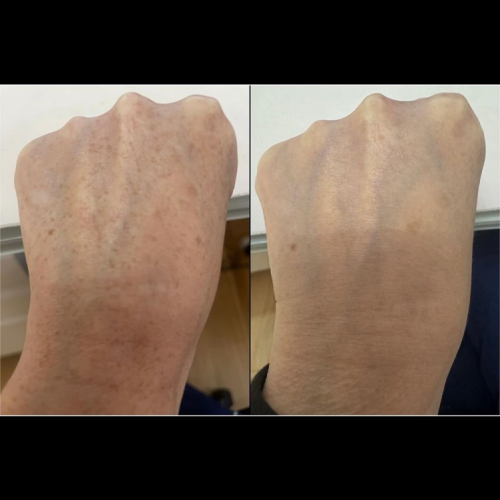 LUMECCA HANDS at Remake Beauty Studio San Juan in San Juan, TX