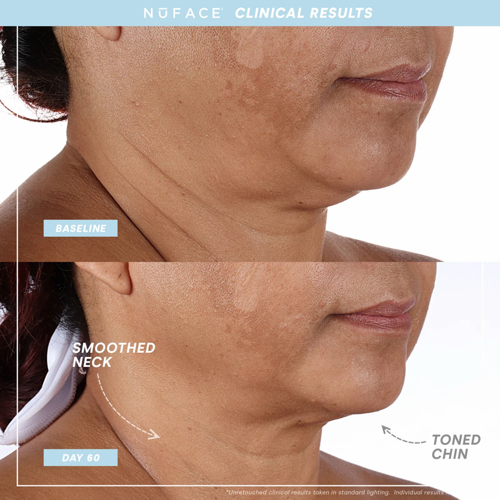 Micro- Current Facial at Covenstead Studio in San Antonio Texas, TX