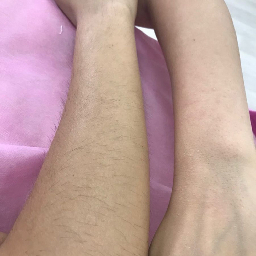 Full Arms Wax at Intimate Wax Studio in Cincinnati, OH