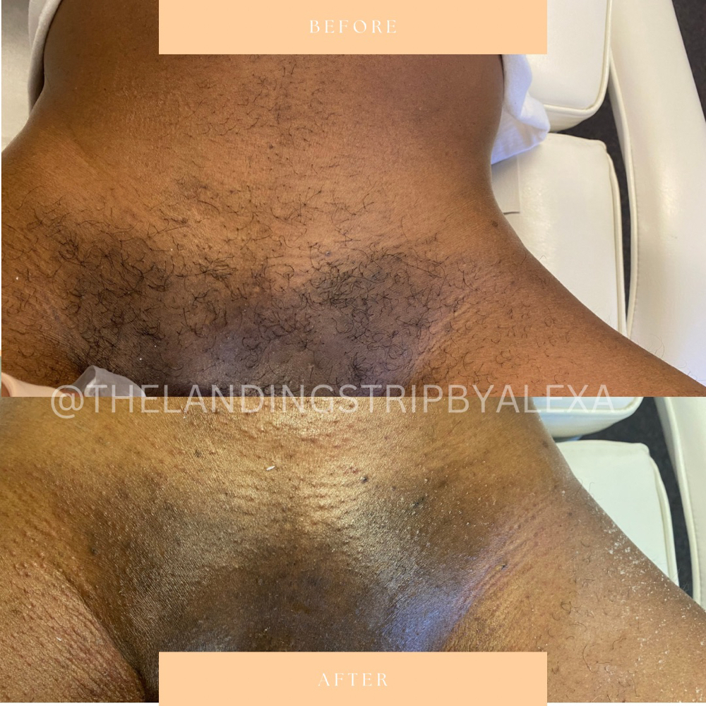 Male Brazilian Wax