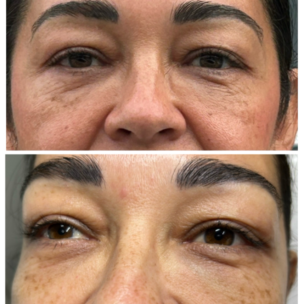 Polynucleotide at Kat Marie Aesthetics in Humble, TX