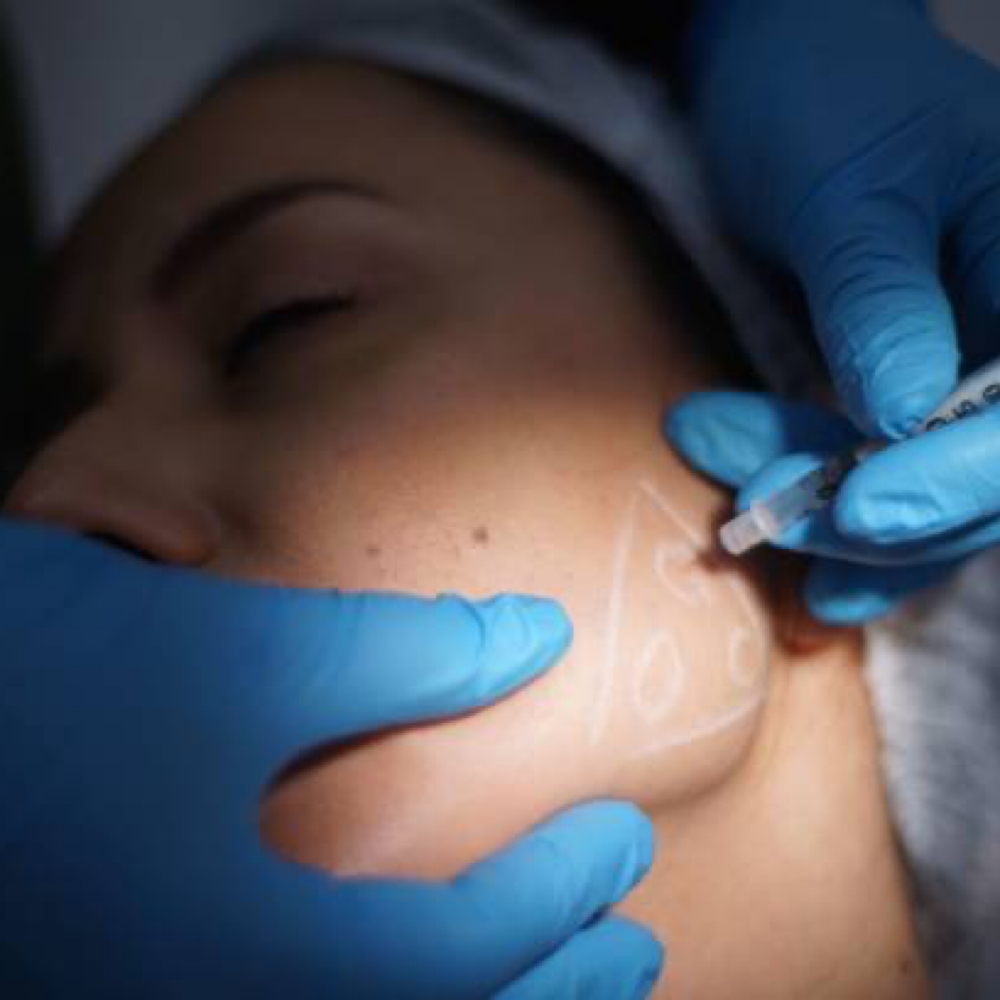 Masseter Botox TMJ at Jaylee’s Beauty Lounge in Eastchester, NY