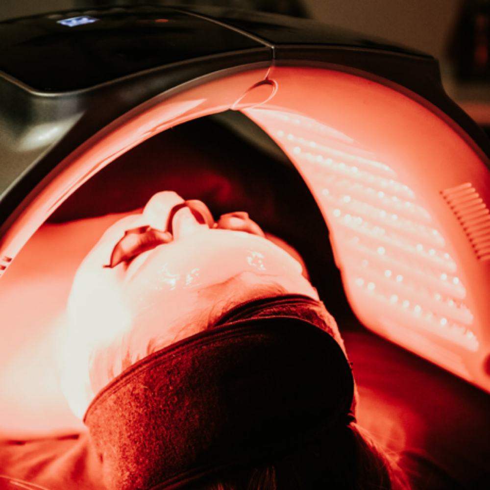 Custom Chemical Peel at Zoe Artistry in Wichita, KS