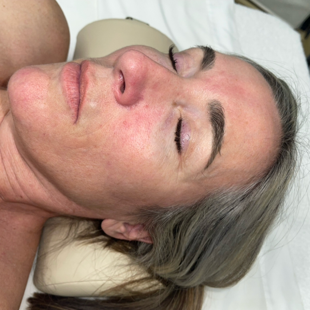 Rosacea/ Sensitive Skin Facial at On The Brite Side Of Skin in Rancho Cucamonga, CA