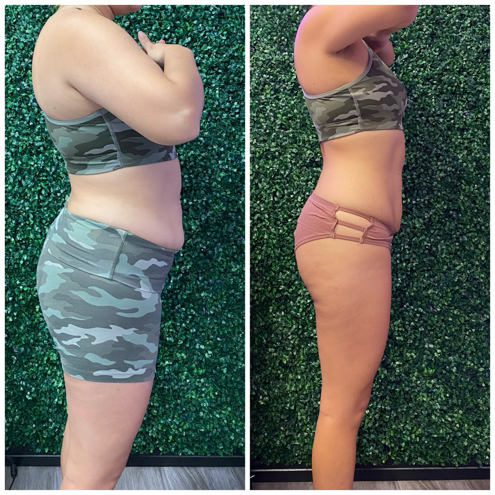 Body Contouring Session at Divinity Essence Spa in Winter Springs, FL