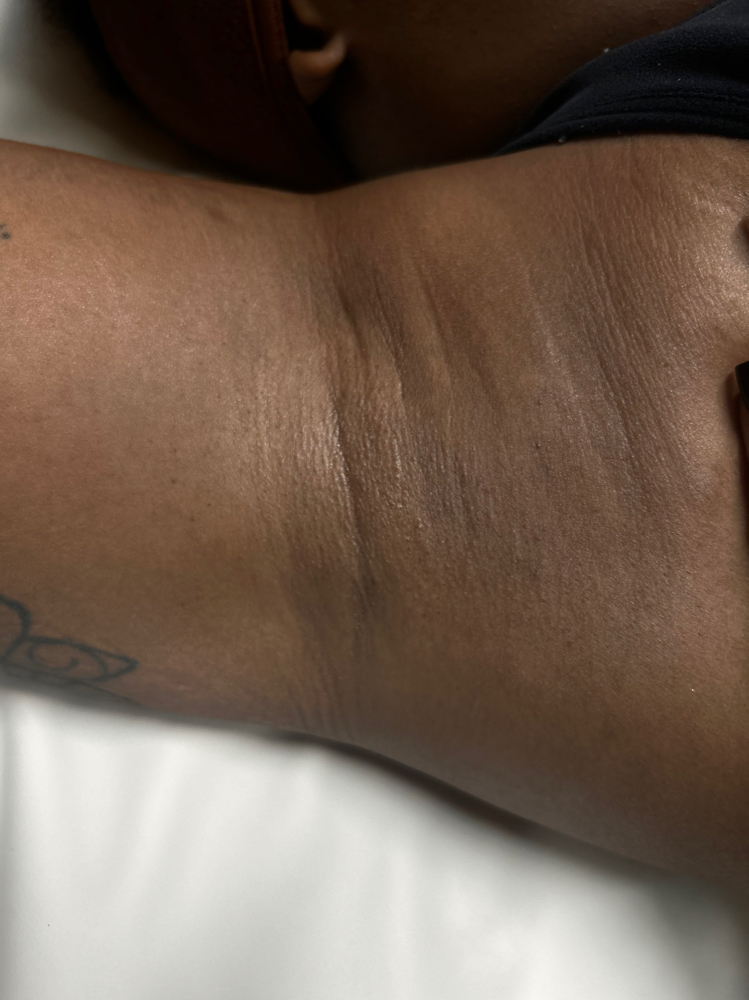 UNDERARMS
