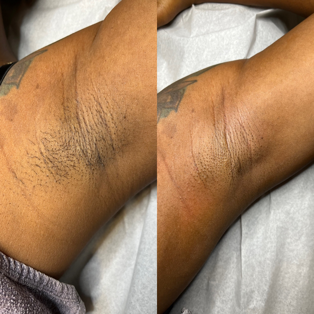 Underarm Wax