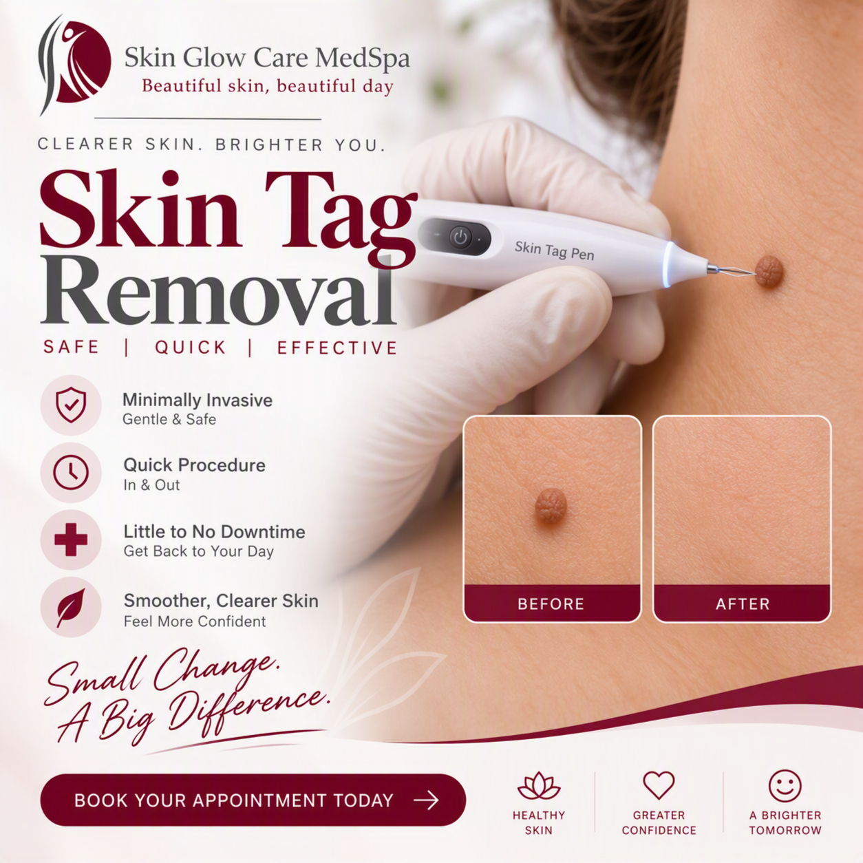 Skin Tag Removal at Skin Glow Care MedSpa in Modesto, CA