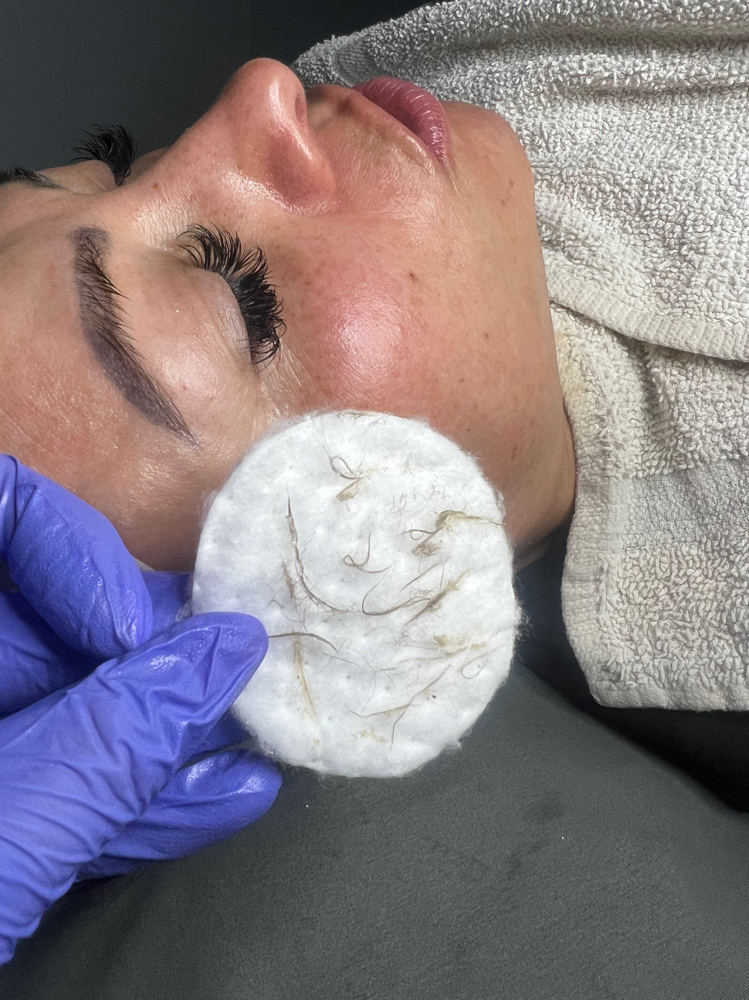 Dermaplane Facial