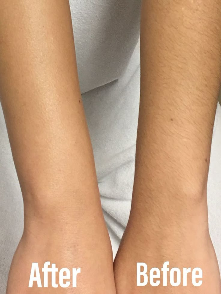 Full Arm Wax