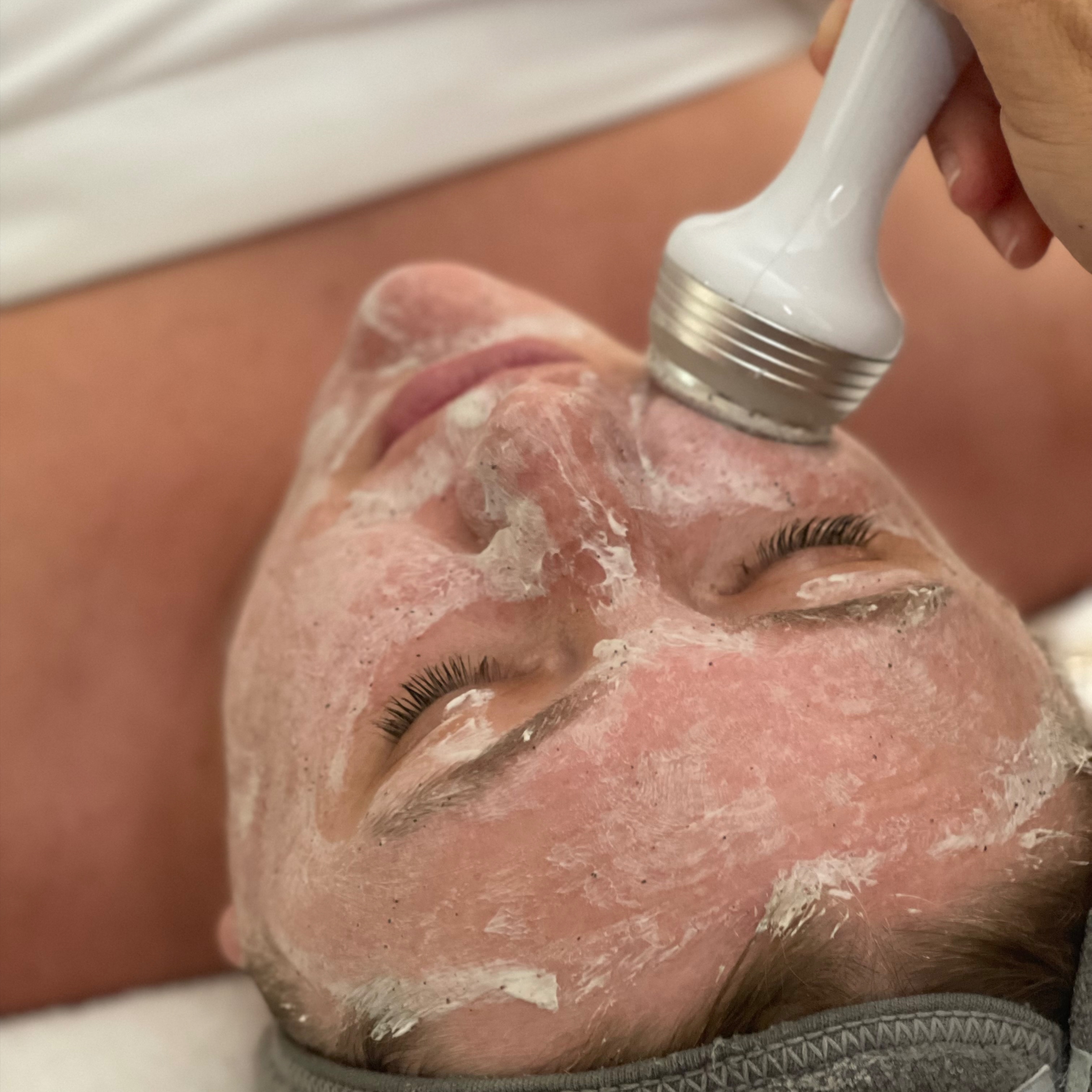 Advanced II Skin Exfoliation at Makeup N Giggles in Key West, FL