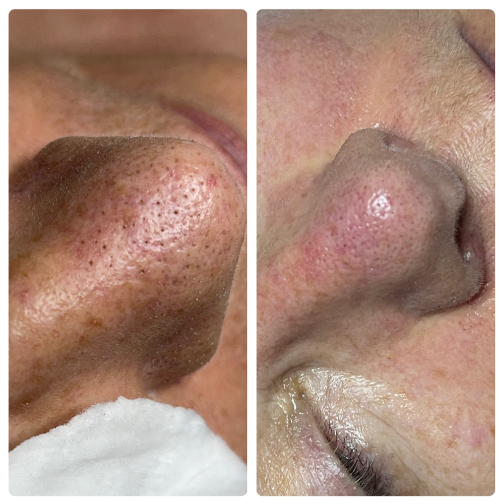Deep Pore Cleanse