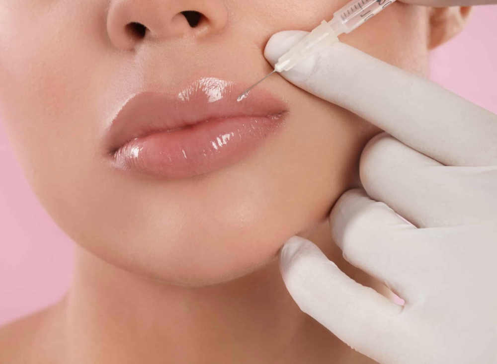 Dermal Filler Injection