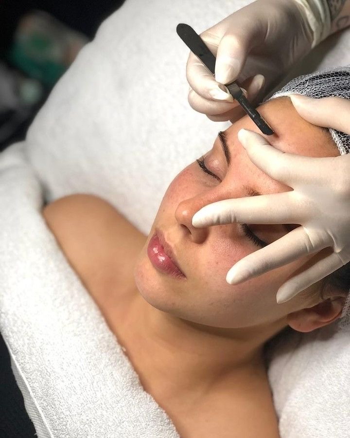 Dermaplane facial
