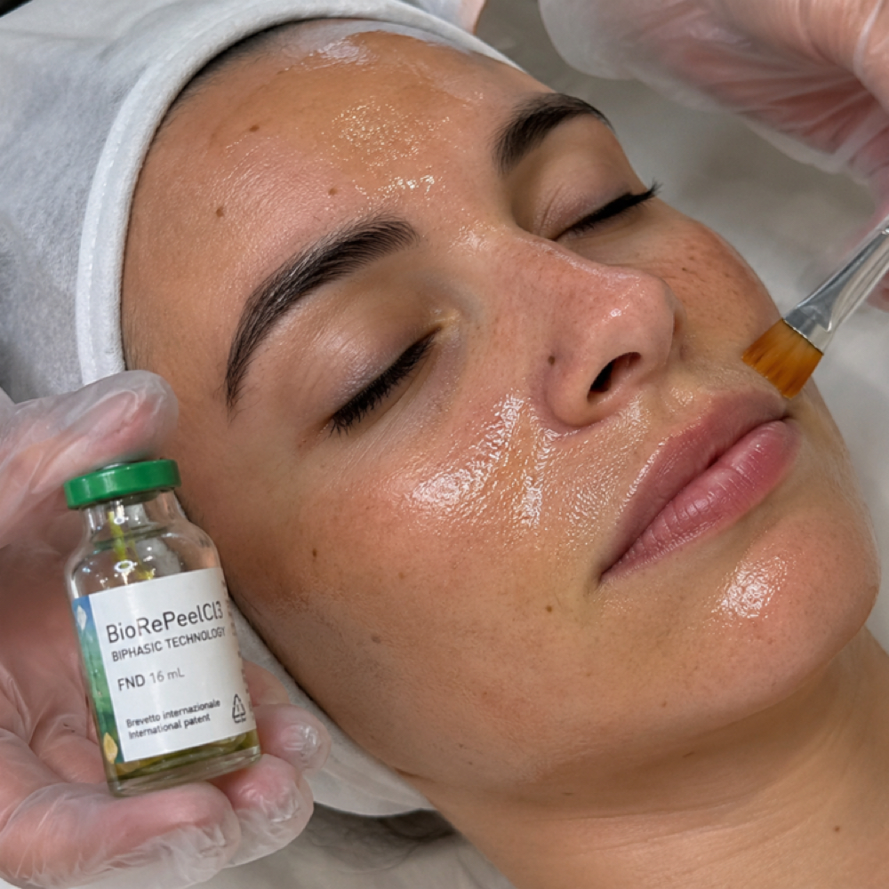 BioRePeel Glow Renewal at Rada Glow Studio in San Diego, CA