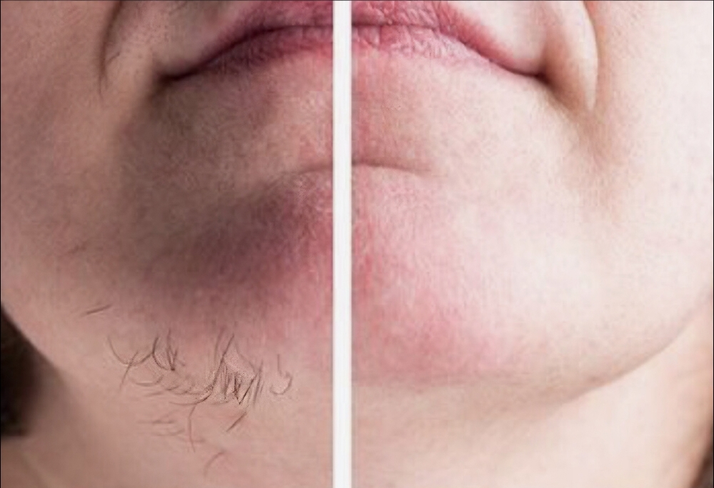 Chin Wax