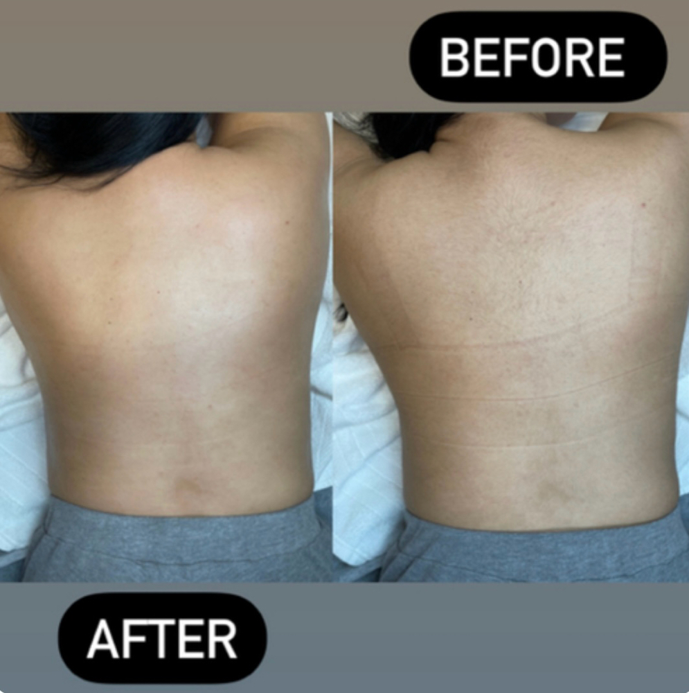 Back Wax