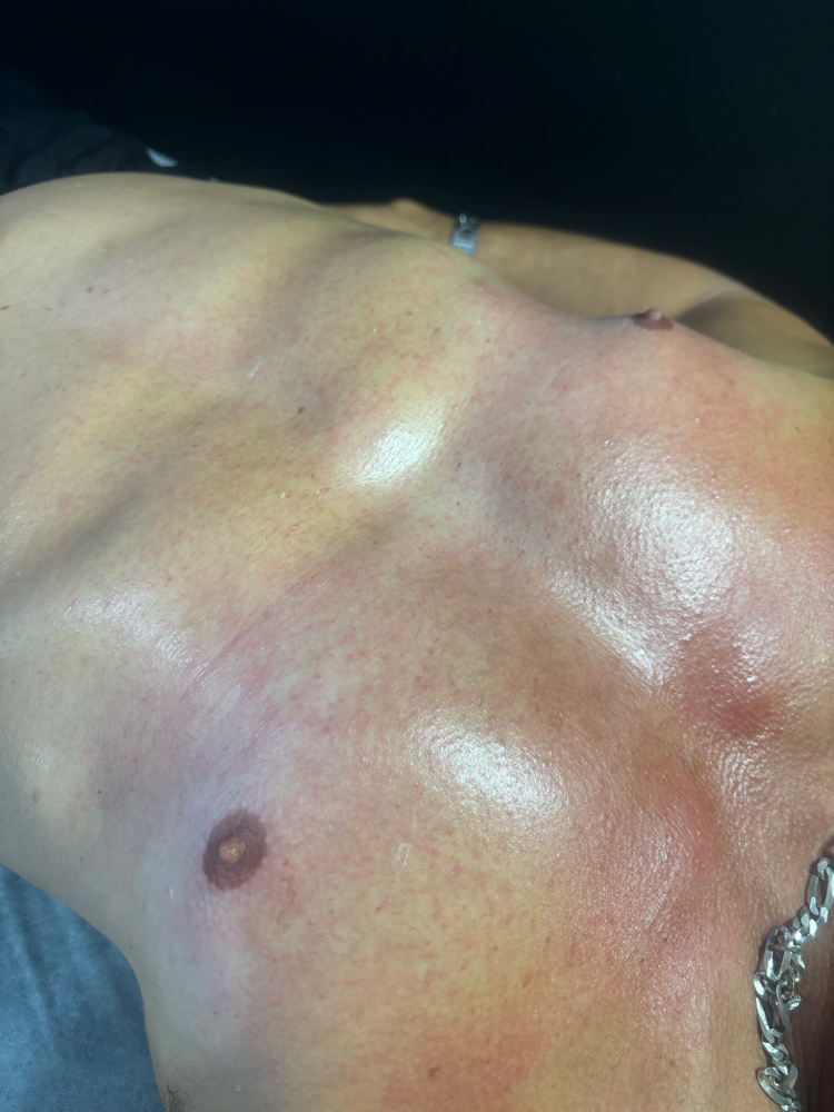 Chest Wax at B YOURBEAUTY in Aurora, IL