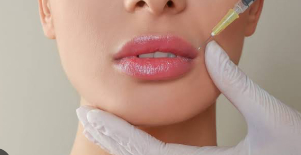 Lip Plump at Lavana Medspa in Edinburg, TX