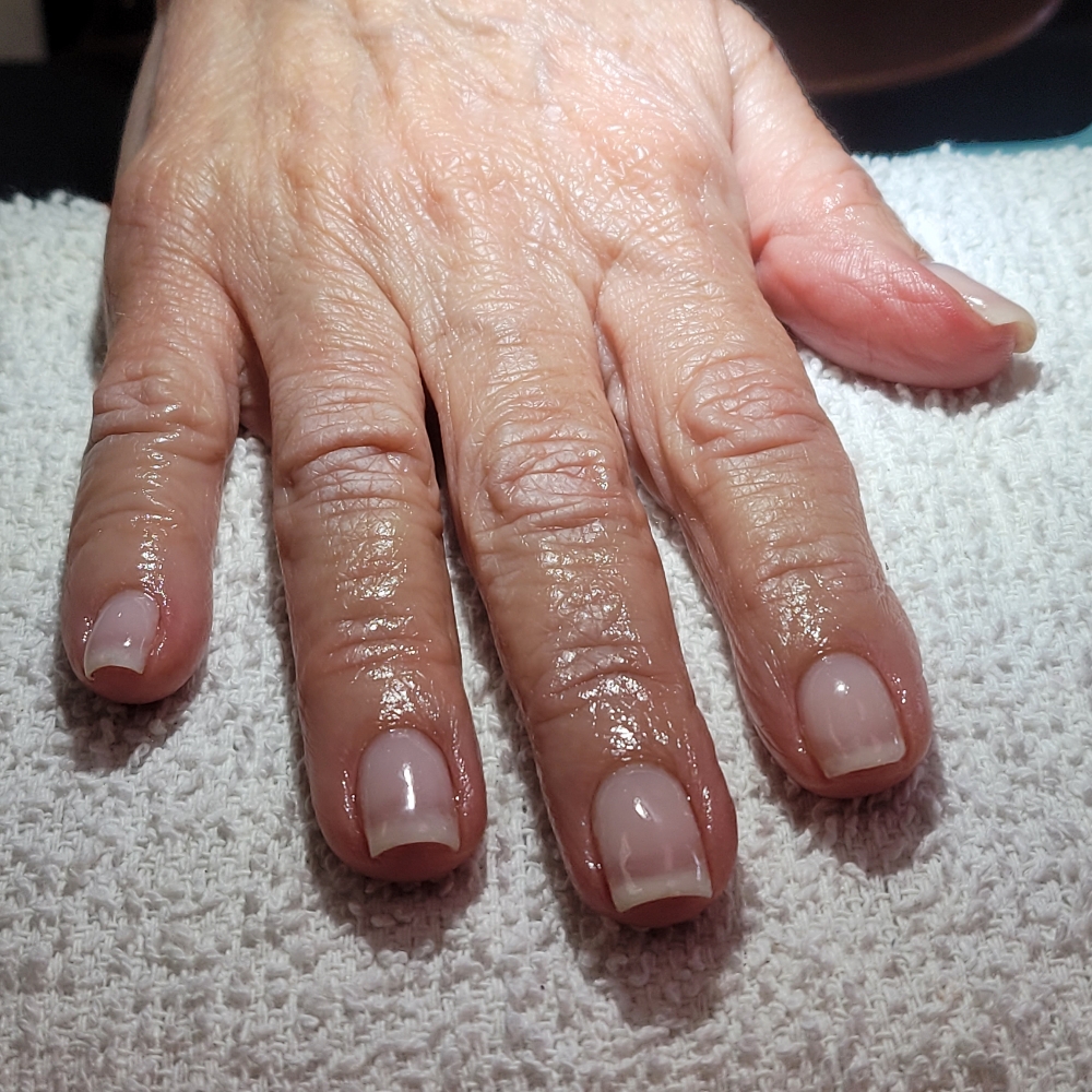 Structured Gel Overlay