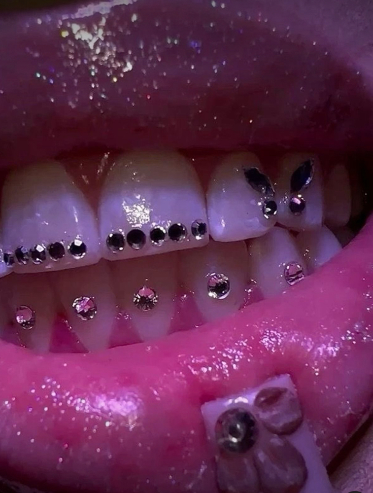 Teeth Gem Replacement