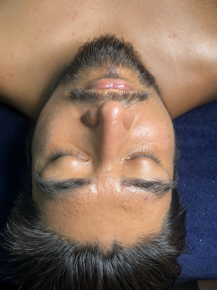 Beard Treatment