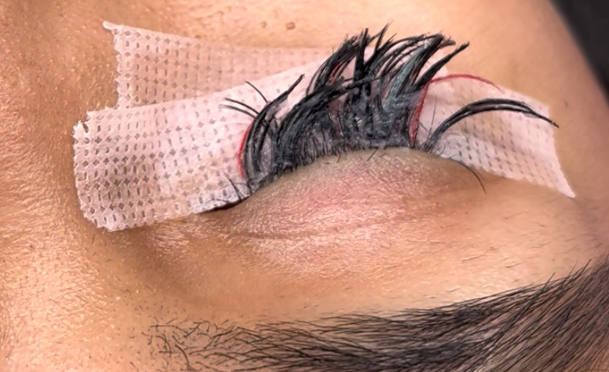 Lash Removal