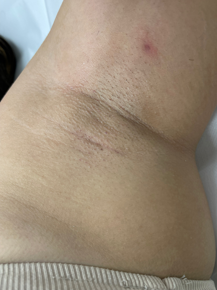 Underarm Wax