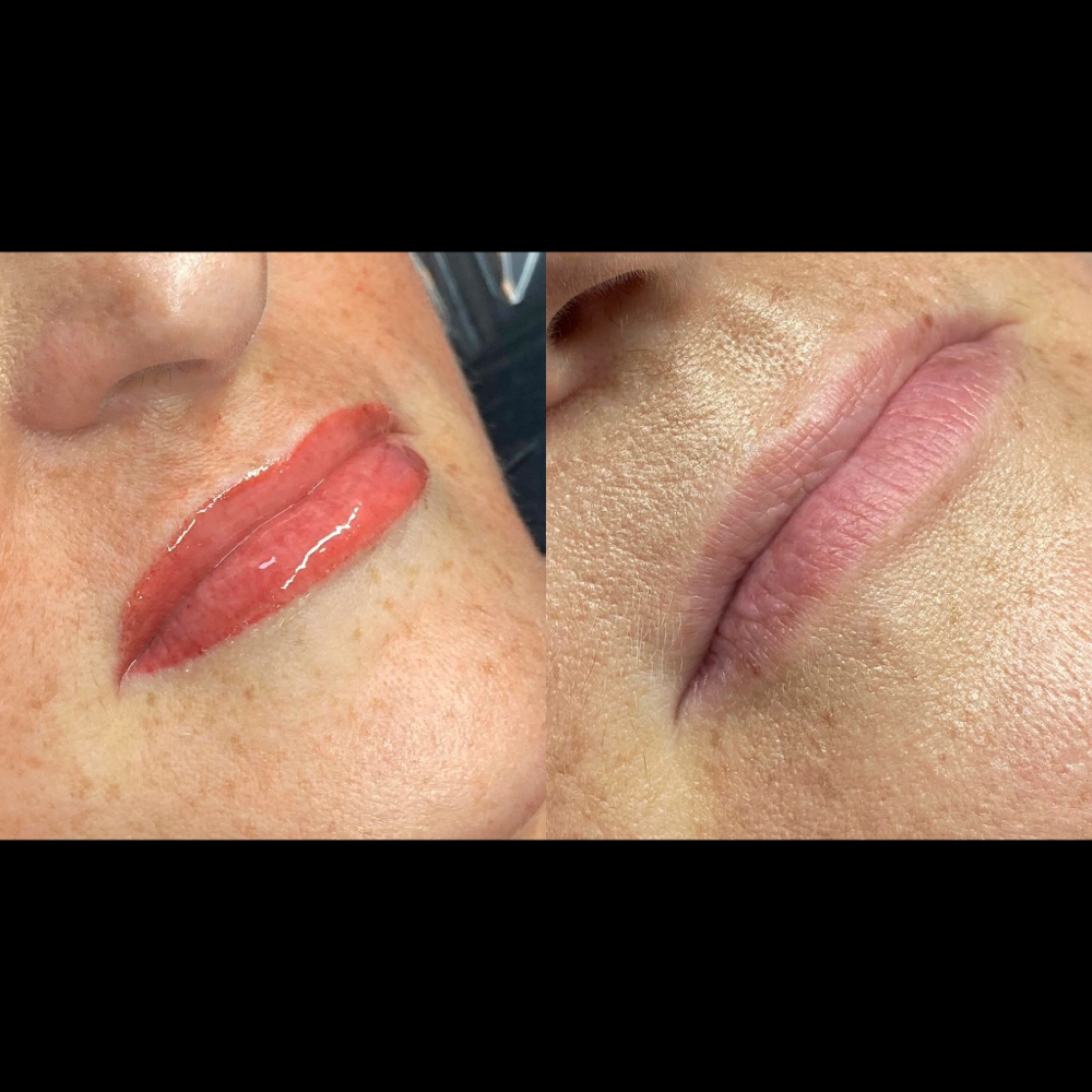 Permanent Lip Blush Consultation