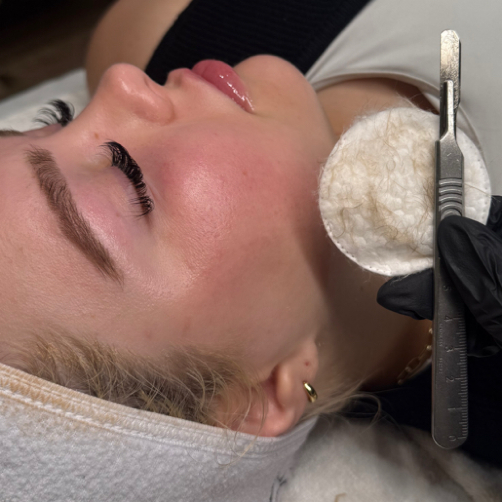 Dermaplaning Facial at Caroline Ply Esthetics in Little Rock, AR