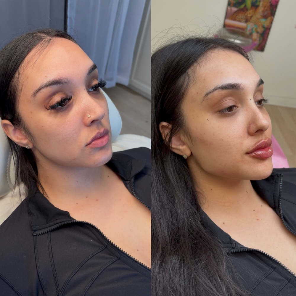 The Full Balance Sculpt 7 Ml at Balance.Bar.Aesthetics in Berkeley, CA