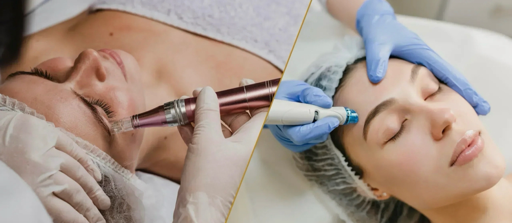 Microneedling X Hydrafacial at Esthetic By Val in Clinton Township, MI