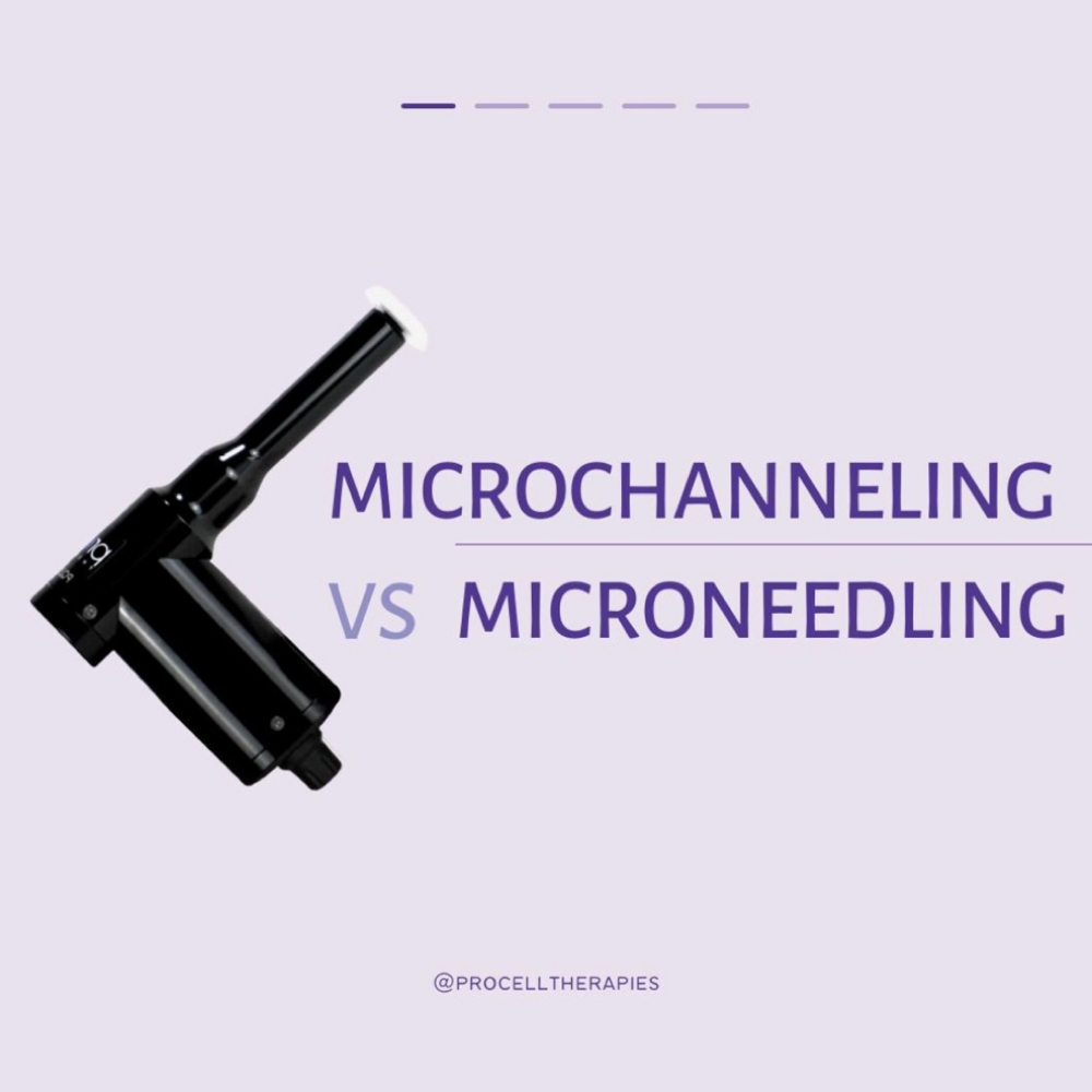 microchanneling neck + decollete at SKNGLO Aesthetics in Victorville, CA