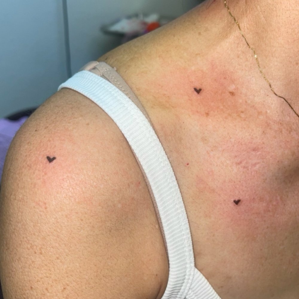 Freckle Hearts 🧡 at Talia in Clovis, CA
