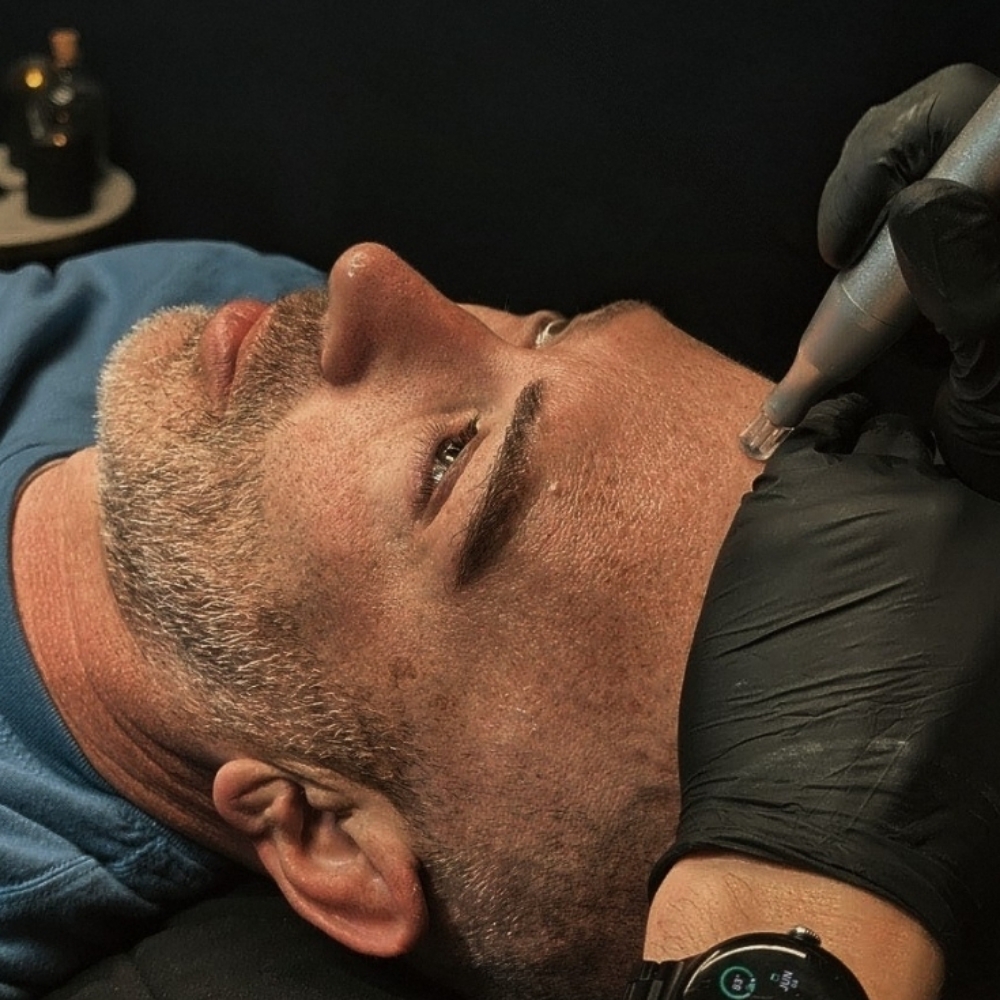 Advanced Skin infusions at Moonlit Esthetics in Minneapolis, MN
