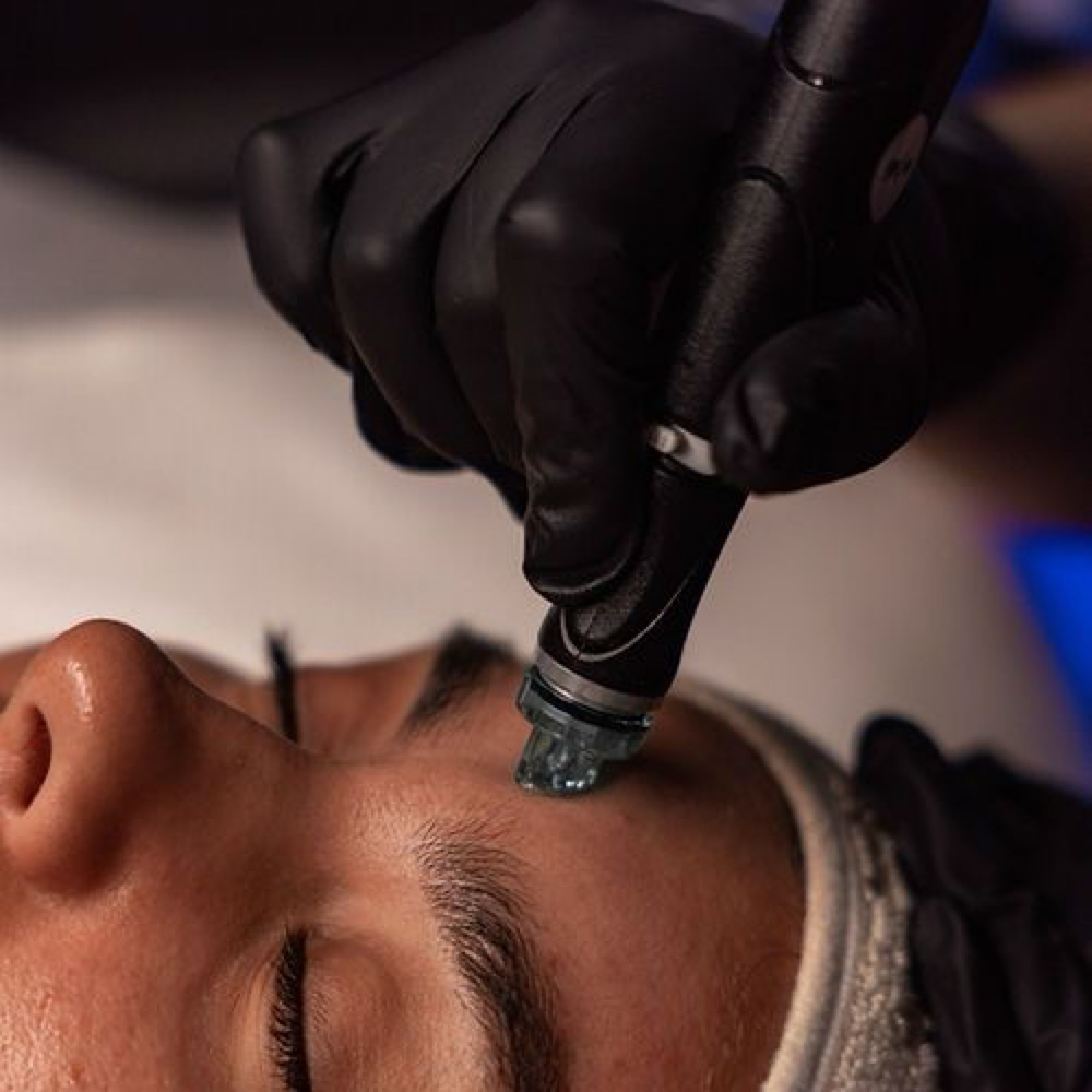 The Iconic Hydrafacial™ at The Lokal Beauty Bar and Skin Clinic in Cleveland, OH