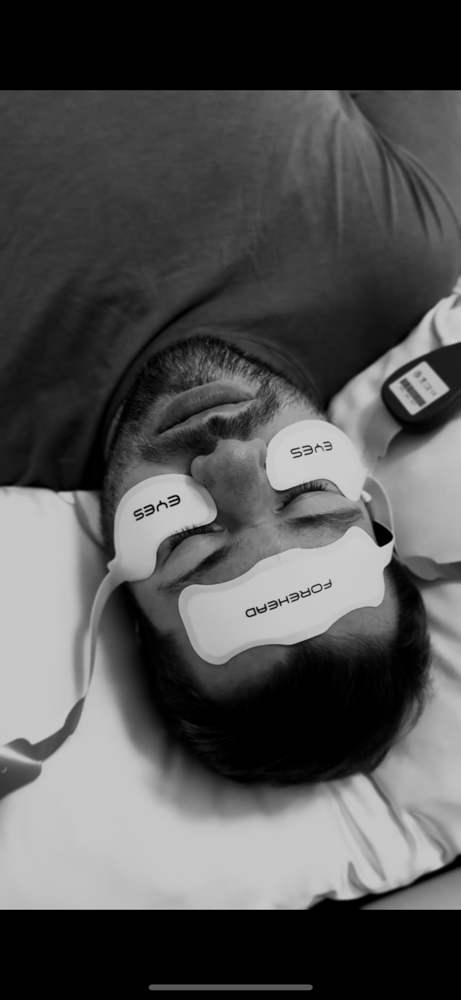 Electrical Muscle Stimulation(Face)