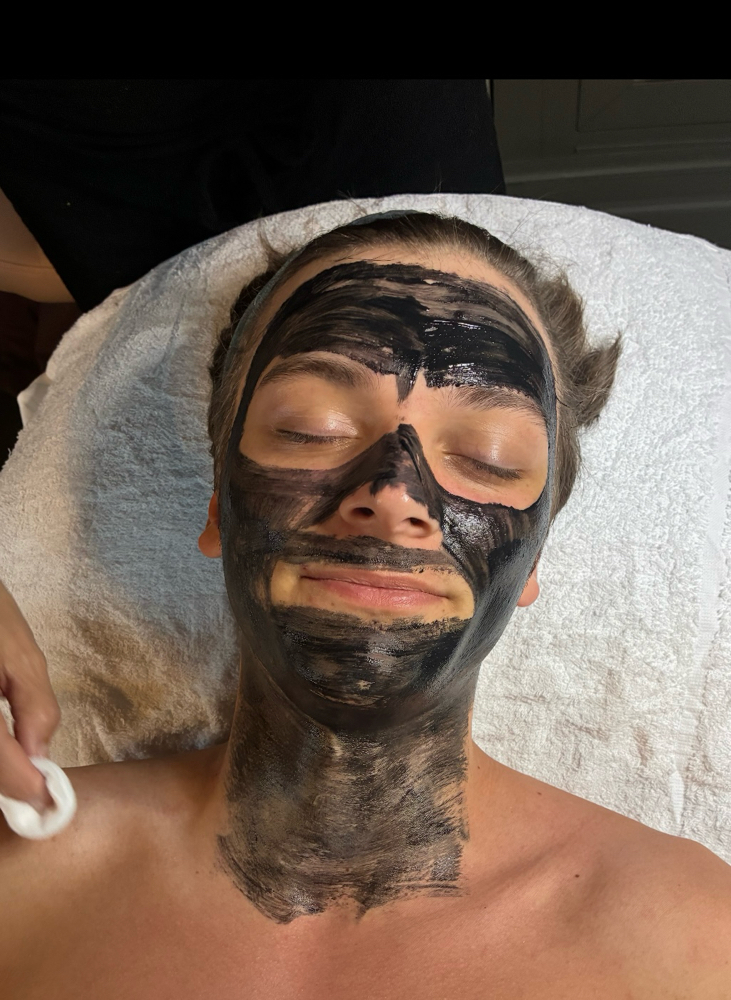 Acne-Detox Facial