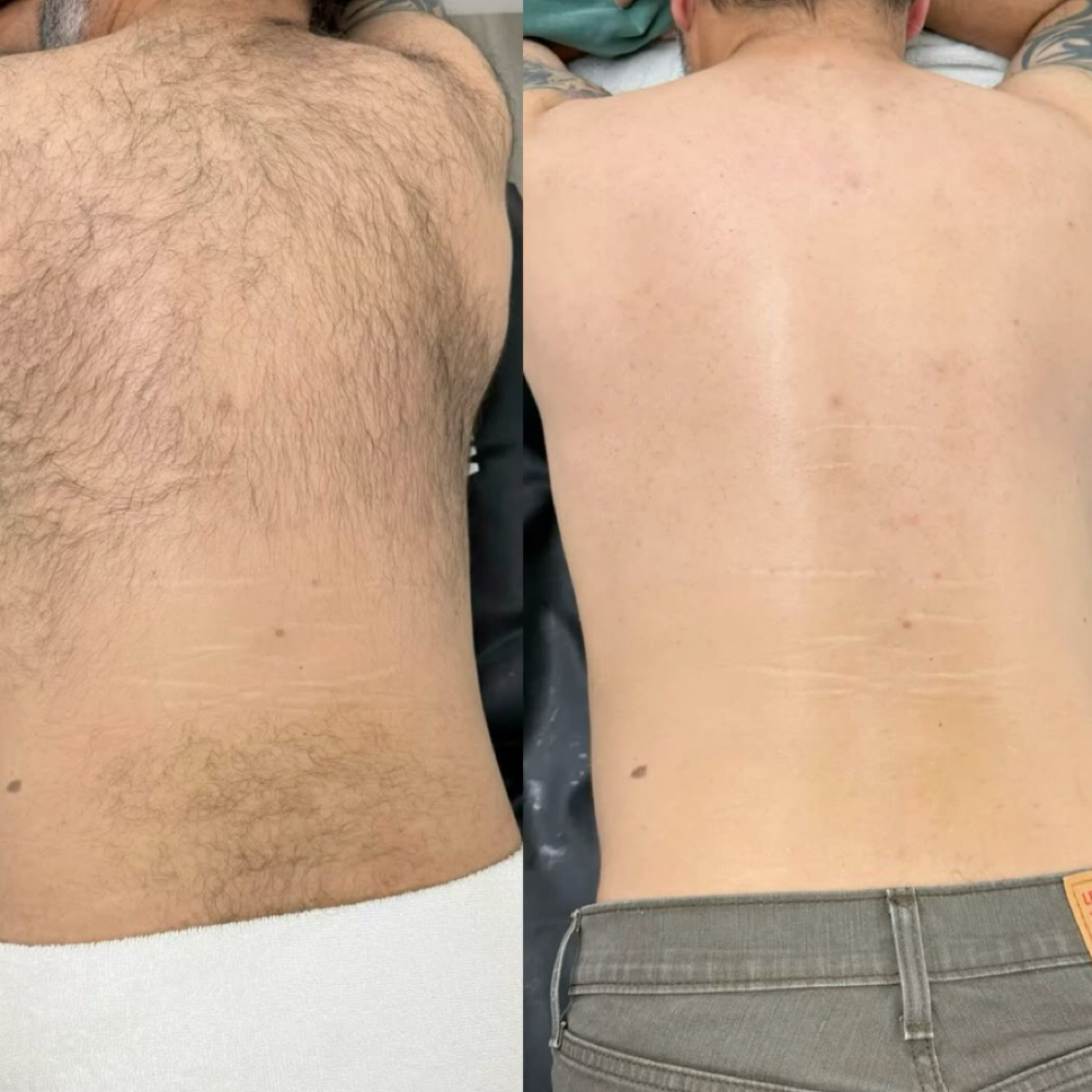 Full Back at 9TwentyNine Waxing Co. in Arlington, TX